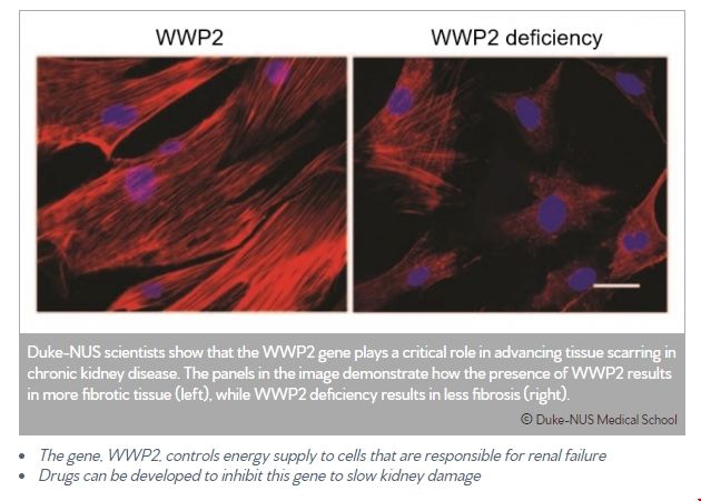 NUS發現阻止慢性腎病新方法.png